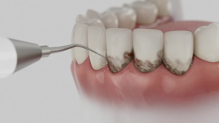 Trusted Tooth Extraction service in Amarillo, TX - Dentist Open Now